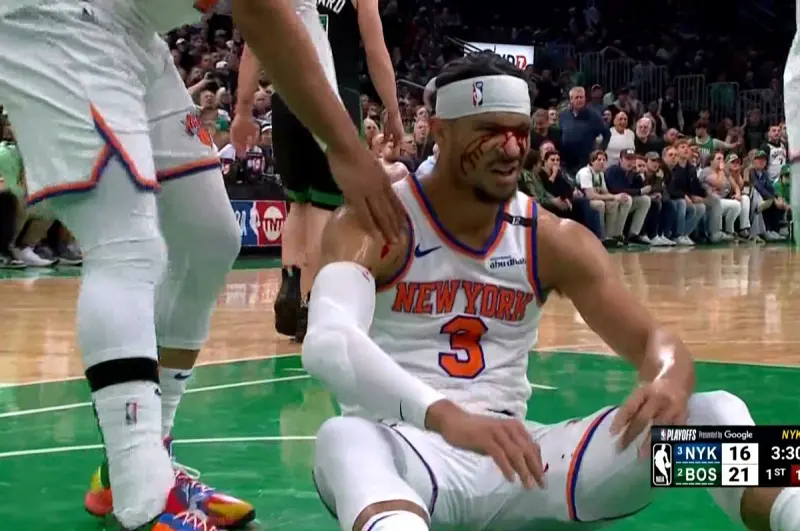 ▲紐約尼克隊後衛Josh Hart在比賽中被塞爾提克球員打到臉，頓時血流如注，但他後續仍然帶傷作戰，打到比賽結束。（圖／翻攝自YouTube）