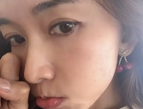 林志玲坎城影展竟出意外！凍齡美貌受影響　哭哭哀求趕快復原
