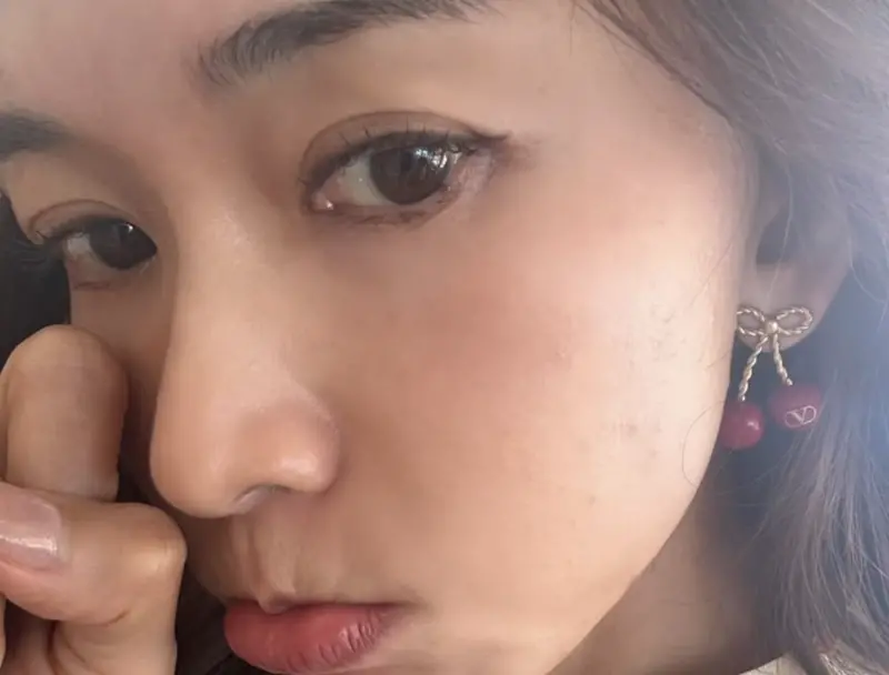 ▲林志玲出席坎城影展的國際女性電影論壇，但人才剛到當地，活動還沒開始，就已經臉部過敏起紅疹，忍不住發文做出「哭哭」的動作，希望趕快復原。（圖／摘自IG）