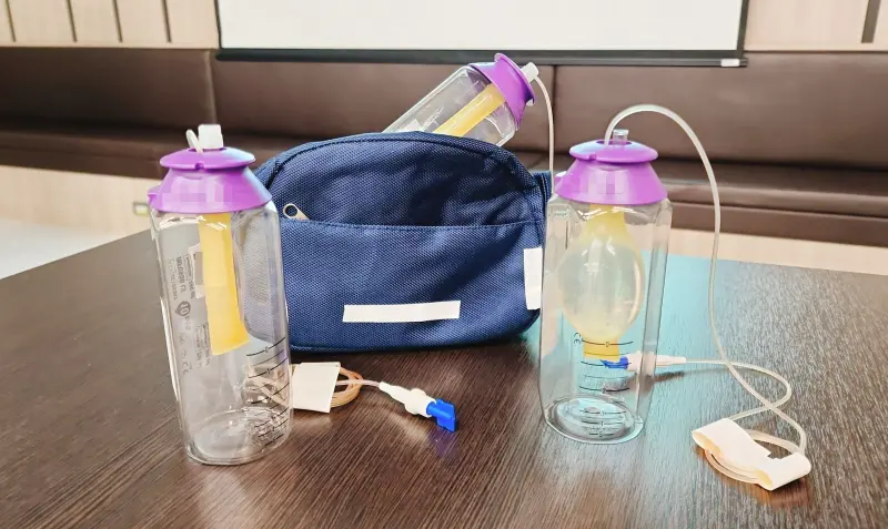 ▲奇美醫院導入攜帶式輸注器，24小時滴注穩定藥效，兼顧療效與病人自由。（圖／奇美醫院提供）