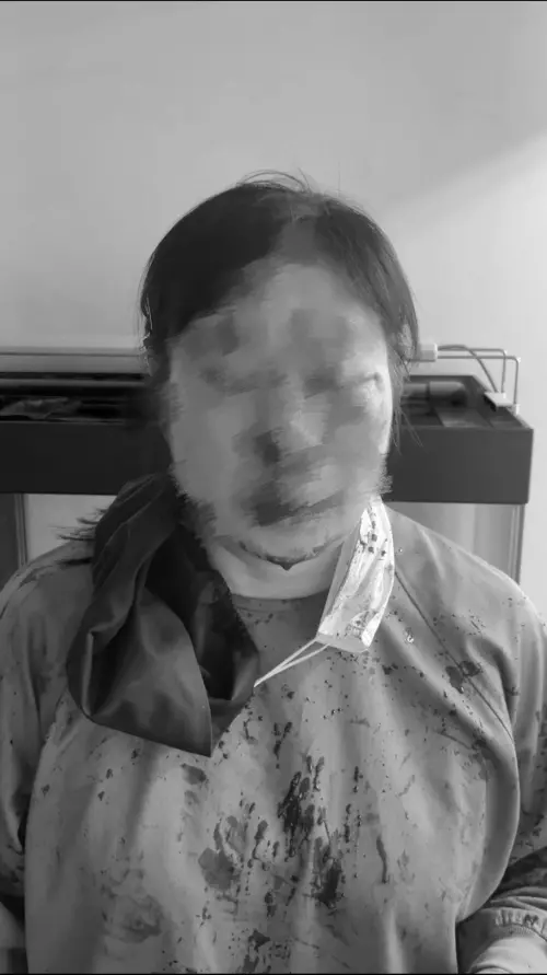 ▲一名20歲男子因不耐洗牙太痛，竟揮拳痛毆女醫師，女醫師被打得滿臉是血，鼻青臉腫。（圖／警方提供）