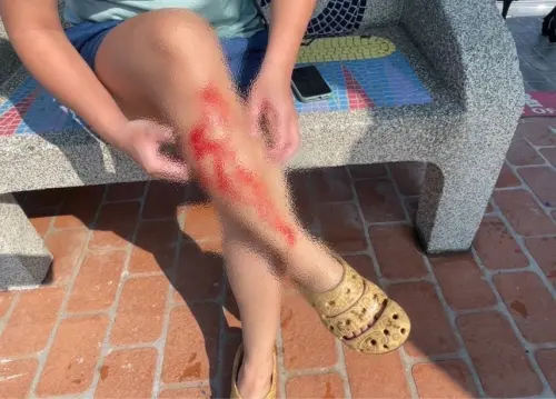 施工廠商棄置鐵釘入海!大安海水浴場成「殺人海域」釀多傷 ▲民眾到剛完工的大安海水浴場玩,竟被施工遺留的尖銳傷刺傷,當場血流如注。(圖/台中市議員王立任提供,2025.05.20)