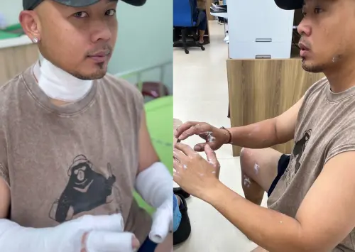 ▲紀曉君發出老公（如圖）受傷的照片，雖然全身多處包紮，但仍笑容滿面逗她開心，夫妻互動感動網友，她也喊話：「老闆休息，老闆娘繼續撐店！」（圖／紀曉君IG）