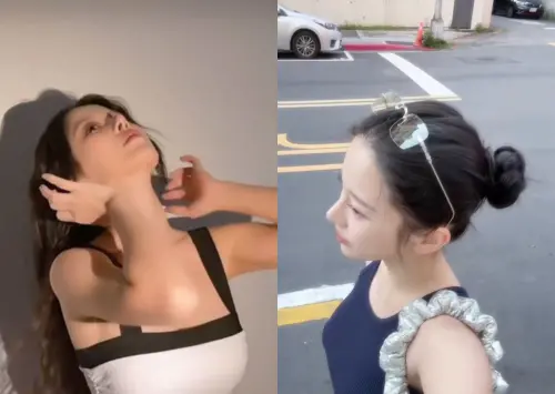 ▲蔡瑞雪被網友質疑長相變化大，Dcard掀討論潮，有人直指她鼻子變尖像「小木偶」，也有人懷疑不只戴牙套，而是整了很多地方。（圖／蔡瑞雪IG）