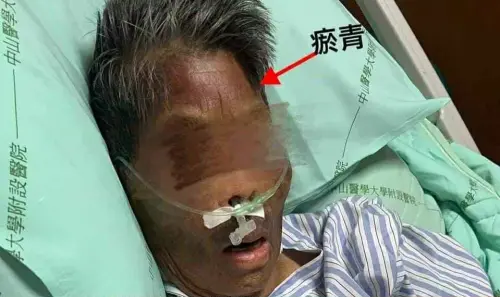 獨/臥床阿嬤鼻青臉腫竟是外傭下重手!家屬痛斥「比惡魔可怕」 ▲8旬老婦臉部和身上瘀青,原本家人認為服用抗凝血藥物所致,調監視器畫面才驚覺外傭下重手。(圖/投訴人提供)