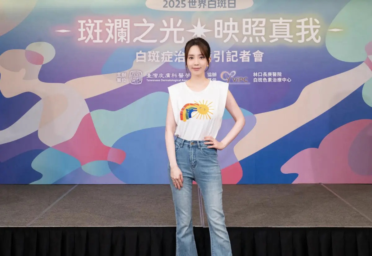 ▲愛雅（如圖）出席2025世界白斑日活動，提到與涉入「大嘴巴風波」的小優近期已經沒怎麼聯絡，只傳過簡訊要對方加油。對於自己的「做人」計畫，則表示太累，暫時沒有很想懷孕，會裝睡，也怕跟老公對到眼。（圖／台灣皮膚科醫學會提供）