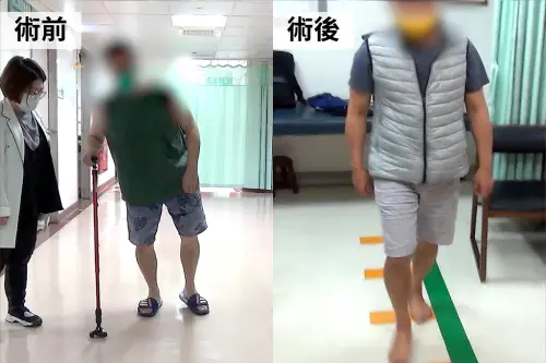 ▲彰基成功為帕金森病友施行清醒式「深部腦刺激手術」,顯著改善顫抖、僵硬與活動力。(圖/彰基提供) ▲彰基成功為帕金森病友施行清醒式「深部腦刺激手術」,顯著改善顫抖、僵硬與活動力。(圖/彰基提供)