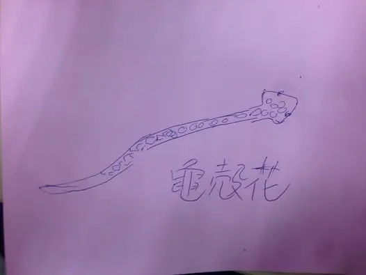 ▲民眾遭毒蛇咬到，還自畫蛇像給醫師參考。（圖／翻攝自臉書粉專「超級白急診醫師」）