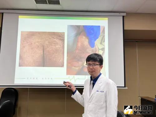 ▲台北榮總皮膚部主治醫師馬聖翔。（圖／記者張乃文）