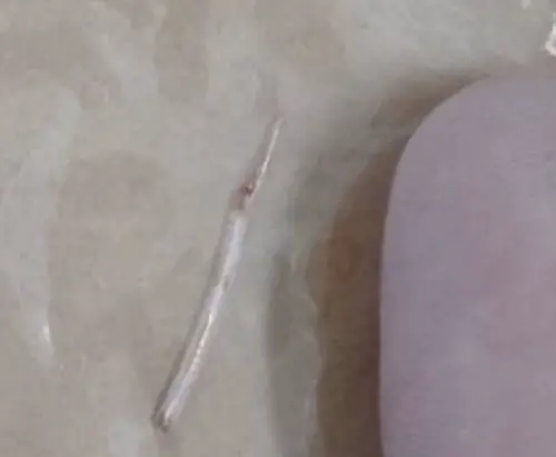 女子被緊急送醫,接受手術取出魚刺,該刺如一個指頭大小。(圖/翻攝自臉書) ▲女子被緊急送醫,接受手術取出魚刺,該刺如一個指頭大小。(圖/翻攝自臉書)
