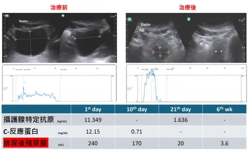 ▲林先生經治療後，殘尿降至20c.c.以下，排尿也恢復順暢。（圖／彰基提供）