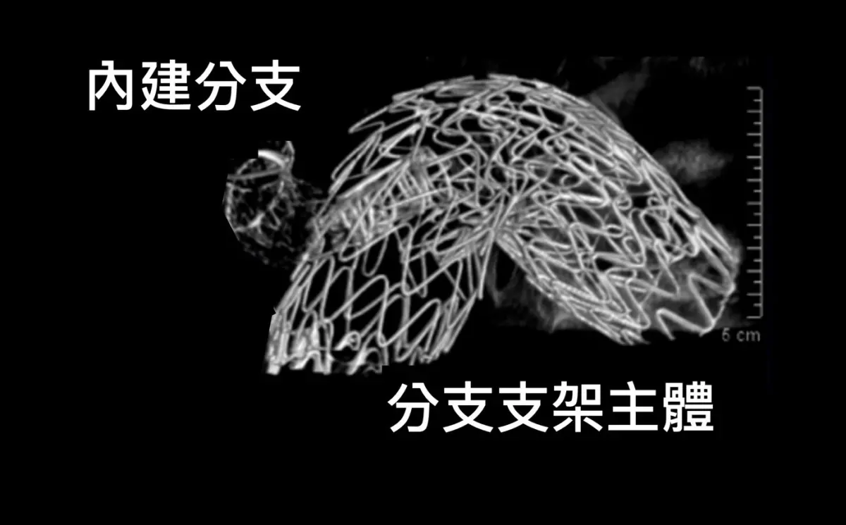 ▲90歲患者進行「胸主動脈分支支架植入術」，在不開胸、不停跳的狀況下順利完成治療，圖為胸主動脈分支支架手術中3D即時重組圖。（圖／長庚醫院提供）