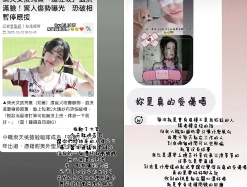 ▲筠熹（如圖）發出動態報平安，「現在已經處理好了，視狀況最壞打算可能無法上班，休息一下就好，也請大家別擔心！」（圖／翻攝自筠熹IG）