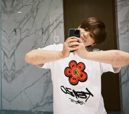 姜濤墜海後手臂滿是傷痕,但他跟粉絲說自己沒事。 ▲姜濤墜海後手臂滿是傷痕,但他跟粉絲說自己沒事。(圖/姜濤IG)