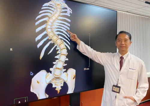 ▲醫師表示，個案脊椎側彎最嚴重部位在胸椎處，台中榮總骨科部脊椎外科主任潘建州。（圖／台中榮總提供）