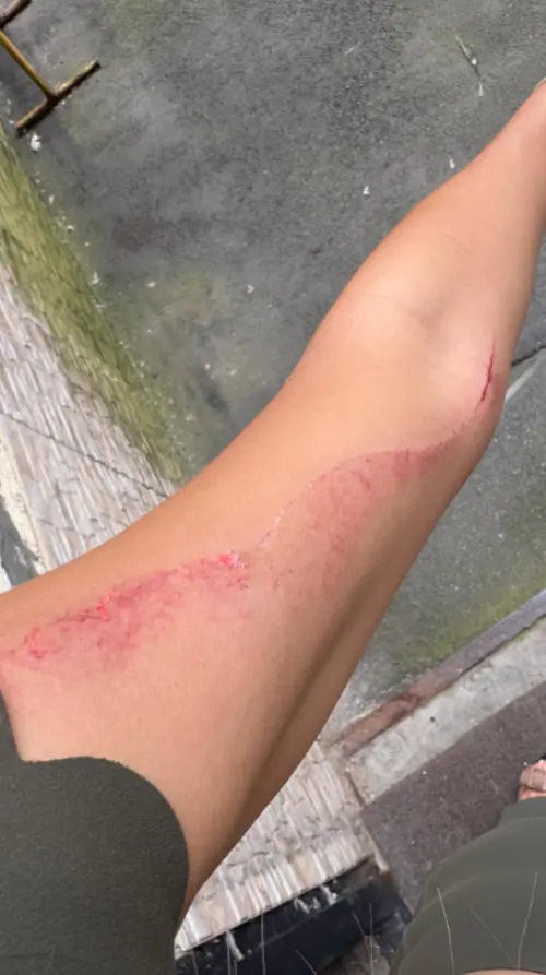 ▲飛烏克蘭拍片！YTR與飯店爆衝突慘見血（圖／小象愛出門Threads）