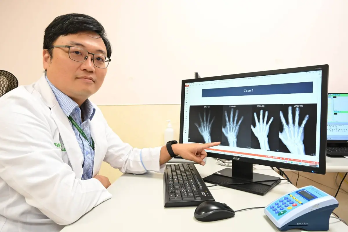 ▲醫師提醒「類風濕性關節炎」的病程發展往往沒有明顯異狀，務必定期追蹤及服藥，才能良好控制病情。(圖／醫院提供2025.7.2)