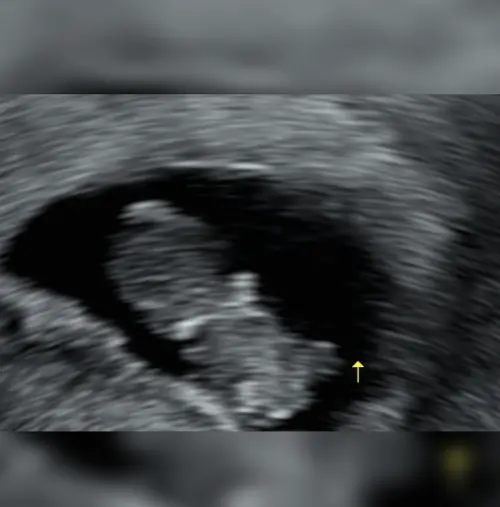 ▲酉奈七月時分享了自己的超音波照。（圖／酉奈IG＠yn_s_1230）