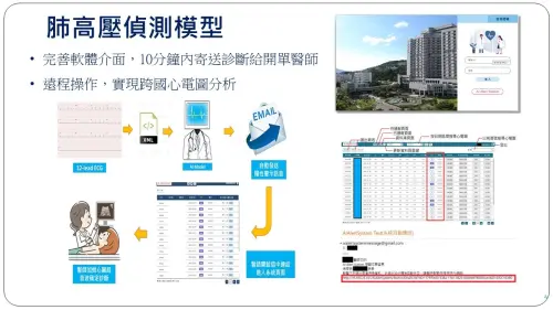 ▲北榮開發人工智慧輔助診斷工具，讓更多高風險族群得以早期發現、早期治療。（圖／北榮提供）