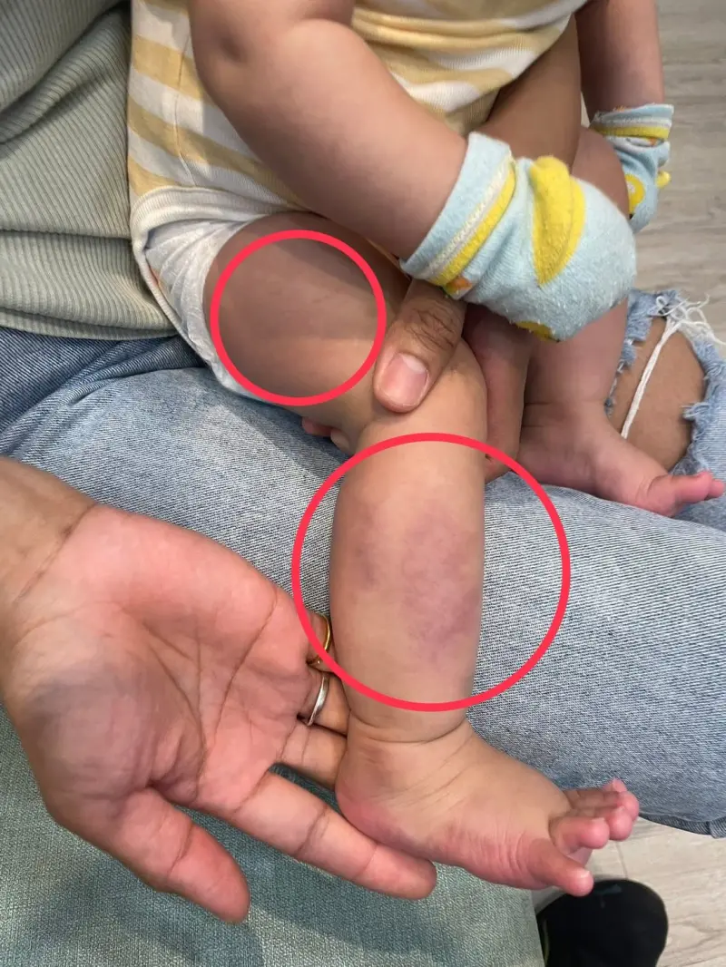 桃園童疑遭保母不當對待　家長心痛PO文　婦幼局：已廢止登記證