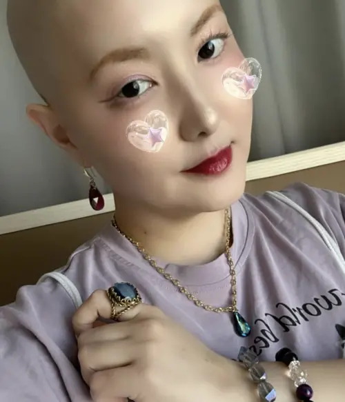 ▲希良梨時常透過IG公開自己接受化療時的照片。（圖／希良梨IG）