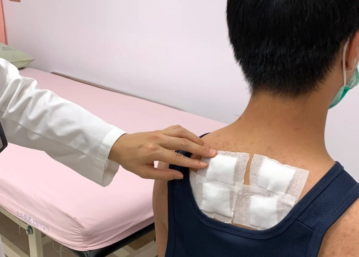 ▲三伏貼是中醫「冬病夏治」療法，可幫助改善和預防秋冬易發作的虛寒性疾病。（圖／台中榮總提供）