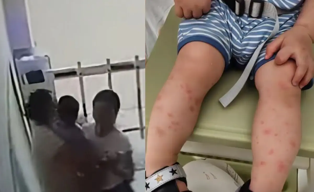 ▲中國一名1歲男童遭鄰居大媽強吻，當晚就高燒、確診水痘，家長事後追查發現，該名大媽的孩子也感染水痘一周前才出院，痛批她明知有傳染風險，卻仍故意接觸他人幼兒。（圖／翻攝自微博）