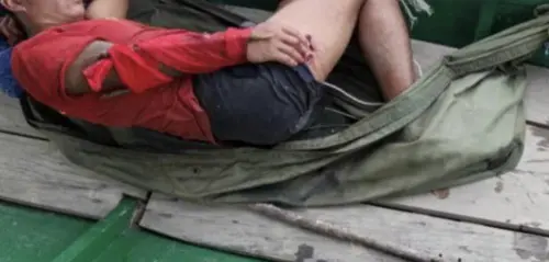 ▲丹尼斯雖然逃過死劫，但全身多處受傷，且右臂骨折，頭部亦有撕裂傷。（圖／翻攝自新海峽時報）