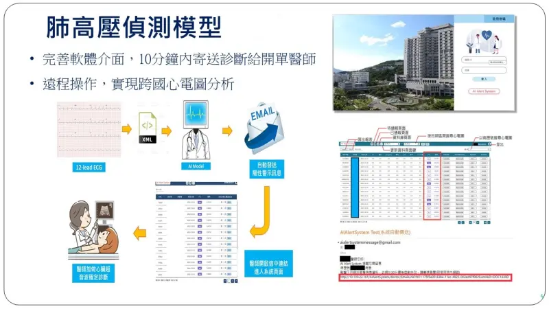 ▲「心電圖肺高壓偵測系統」可快速分析心電圖，將肺高壓患者陽性結果即時傳送給臨床。（圖／台北榮總提供）