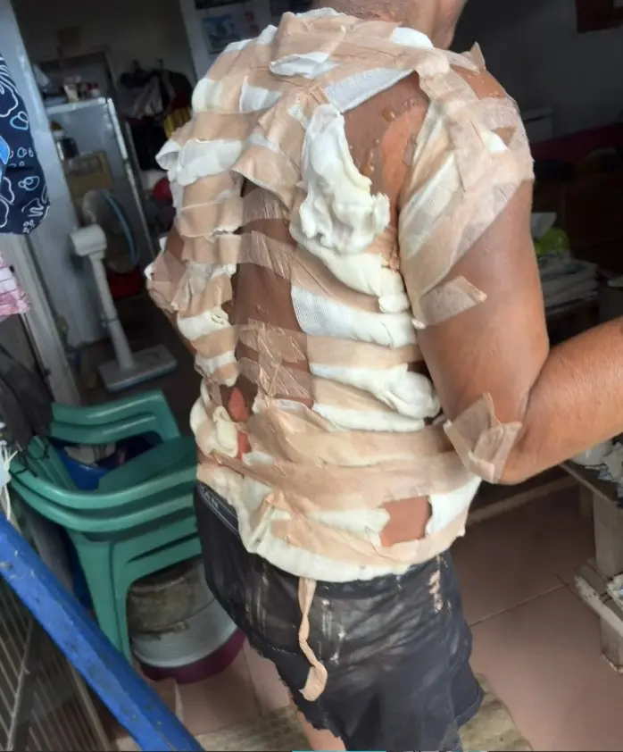 蘭嶼男深夜遭潑滾燙熱水！住加護病房命危　警調監視器緝凶