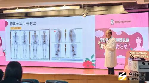 ▲陳芳銘強調，相關研究在在顯示，早期荷爾蒙陽性乳癌患者無論是否出現淋巴結轉移，只要呈現某些指標就屬於高復發風險族群。（圖／記者陳美嘉攝，2025.07.31）