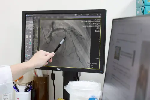 ▲患者冒冷汗、胸悶就醫，發現心臟三條冠狀動脈皆有嚴重狹窄情況。（圖／員榮醫院提供）