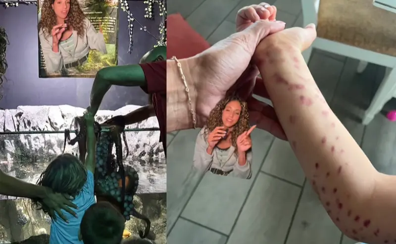 ▲美國一名6歲男童到水族館參觀時與章魚互動，不料卻遭觸手纏上，整個手臂都佈滿恐怖瘀傷。（圖／翻攝自tiktok）