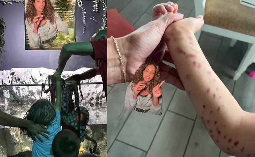 ▲美國一名6歲男童到水族館參觀時與章魚互動，不料卻遭觸手纏上，整個手臂都佈滿恐怖瘀傷。（圖／翻攝自tiktok）