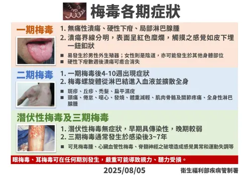 ▲疾管署提醒梅毒各期症狀。（圖／疾管署提供）