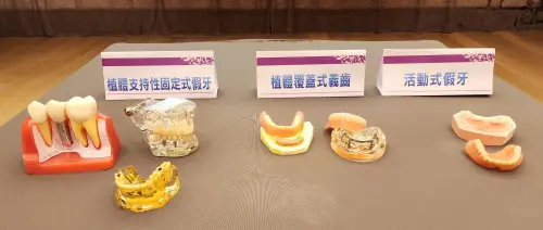 ▲植體支持性固定式假牙、植體覆蓋式義齒、活動式假牙示意圖。（圖／奇美醫院提供）