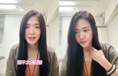 ▲楊千霈術後喪失味覺與嗅覺！爆瘦4公斤首露面　淚喊：會盡快康復。（圖／IG@pinkbabe0309）