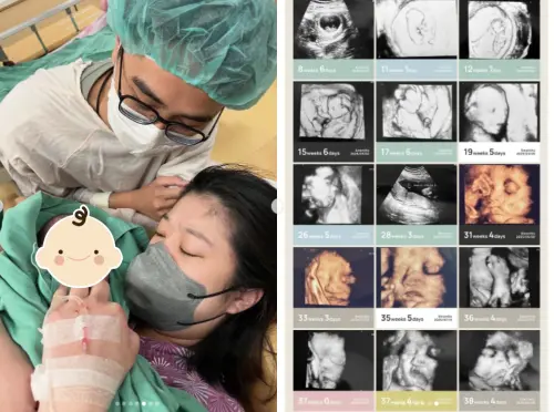 ▲荒姨（圖／翻攝自荒姨IG＠hhhuangyiii）