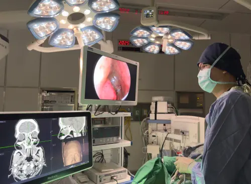 鼻竇炎合併鼻息肉！手術+生物製劑建功　鎖定「第二型發炎」奏效
