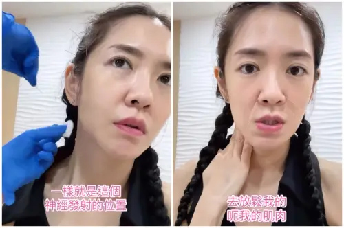 ▲楊千霈手術摘除扁桃腺　失去嗅覺、味覺求救中醫（圖／楊千霈IG@pinkbabe0309）