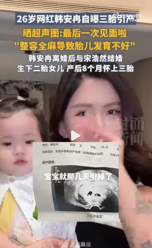 ▲懷孕初期動整形手術　韓安冉全身麻醉疑影響胎兒（圖／翻攝自封面新聞微博）