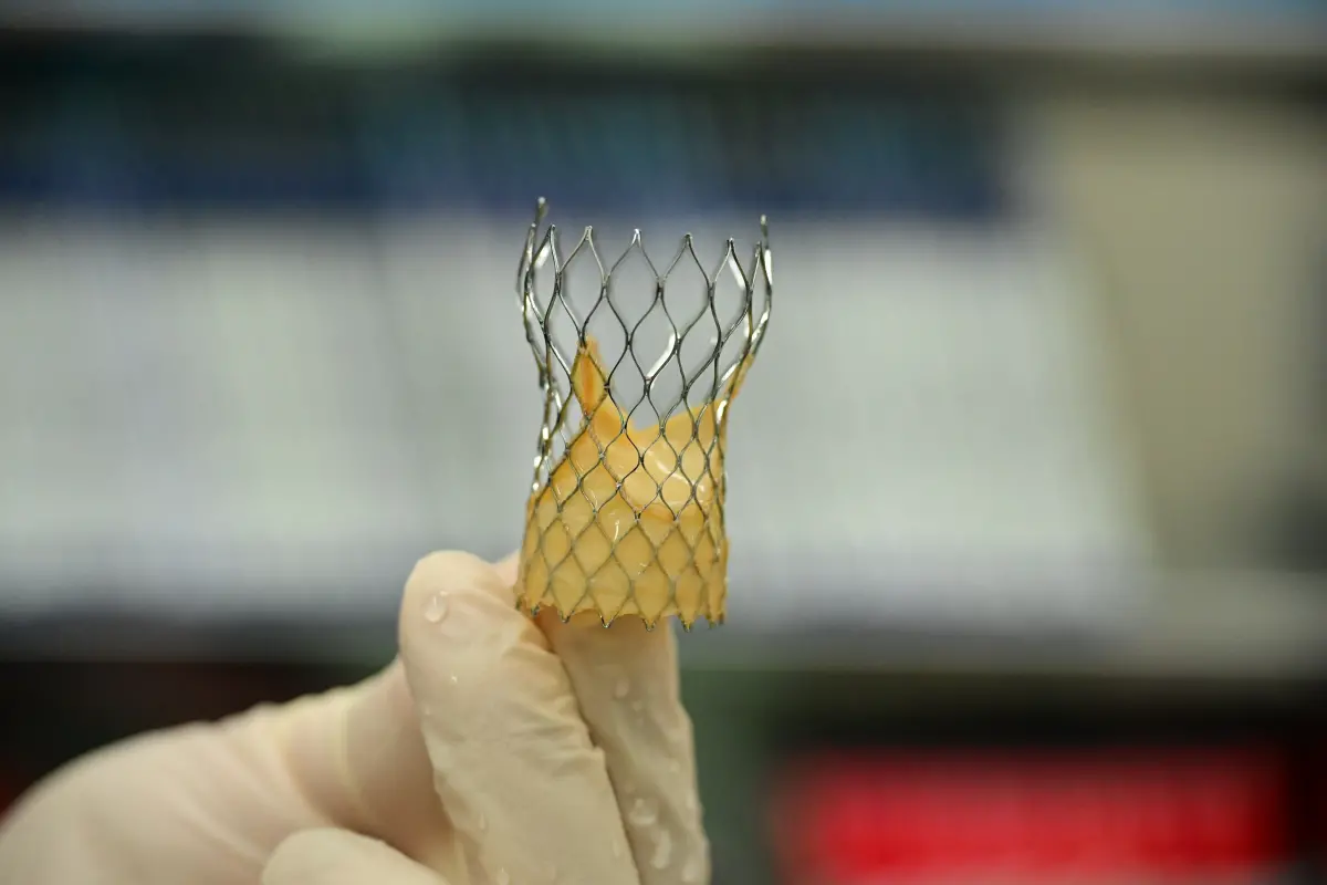 ▲醫療團隊植入網狀記憶金屬生物瓣膜，取代病變瓣膜(圖／醫院提供2025.8.26)