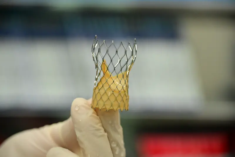 ▲醫療團隊植入網狀記憶金屬生物瓣膜，取代病變瓣膜(圖／醫院提供2025.8.26)