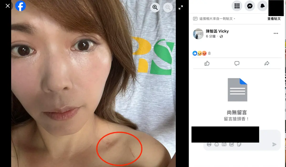 陳智菡「走讀」傷勢曝光 揭警察強推、抓項鏈：要辦就來！