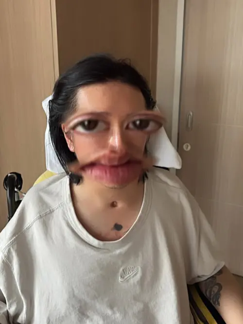 ▲阿Mo近日曬出近況照，明顯看得出喉嚨下方還有氣切過的痕跡。（圖／翻攝自阿Mo IG@momo.lky）