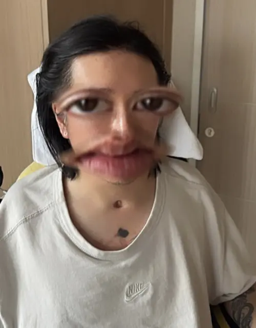 ▲李啟言近況照片曝光，可以看見他脖子上有著插管治療的傷口。（圖／＠momo.lky IG）