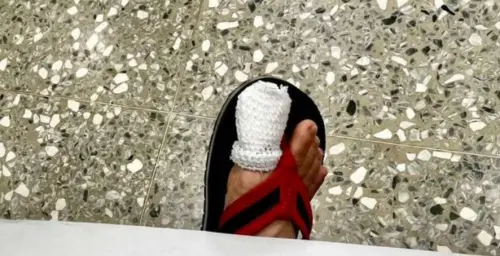 台南市場驚見老鼠咬人！女子腳趾頭刺痛流血　趕緊就醫打破傷風針
