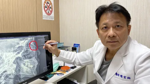 ▲醫師說明，顏面骨折在外觀上不一定嚴重，卻可能隱藏深層危機，且不僅與外觀相關，更可能影響器官功能。（圖／員榮醫院提供）
