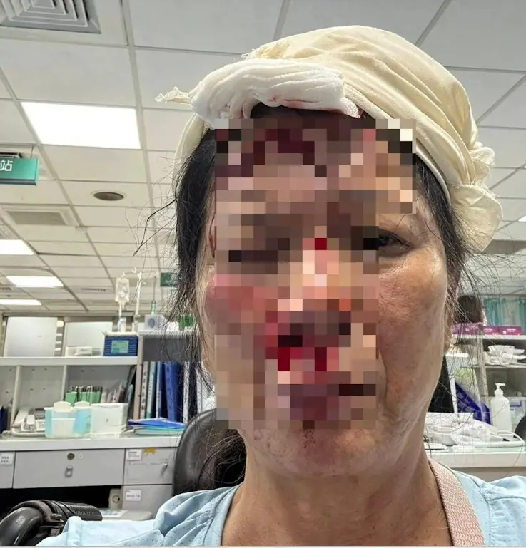 ▲受傷婦人步出超商店門，不慎跌跤向前撲倒，撞上路燈基座的凸出物受傷，頭部當場血流如注。（圖／翻攝畫面）