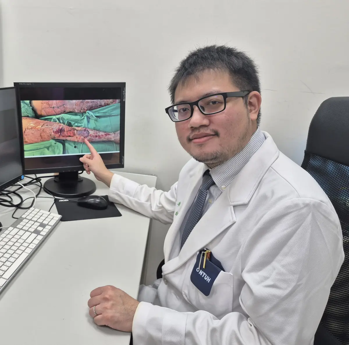 ▲卓衡醫師說明病人燒燙傷治療策略與相關照護計畫。（圖／新竹臺大分院提供）